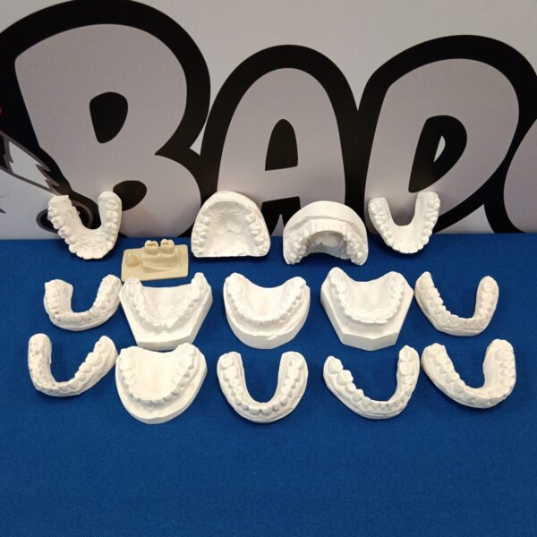 Vintage plaster cast teeth for dental study and collection.