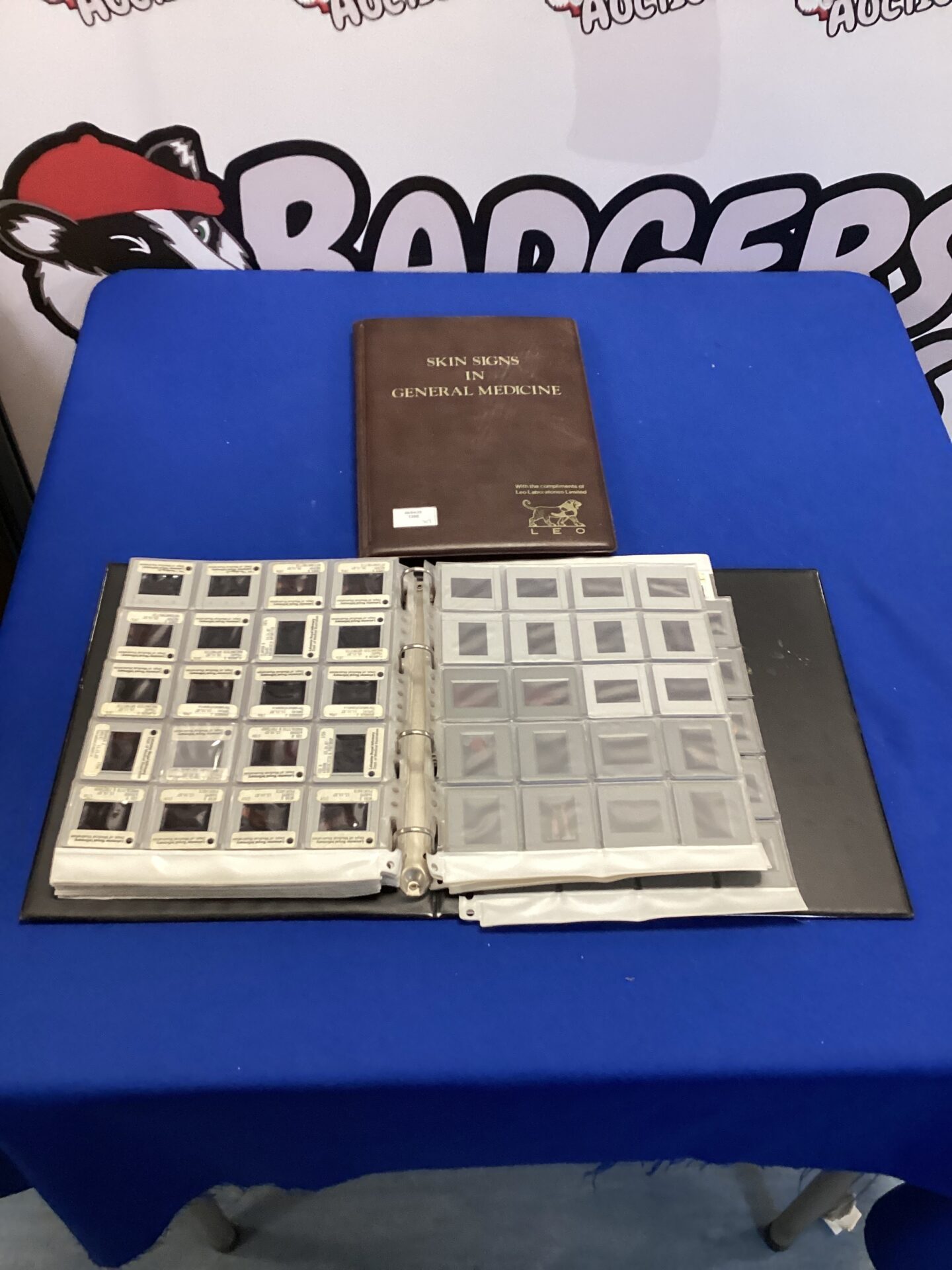 524 Two folders of 35mm slides of various skin signs in general medicine